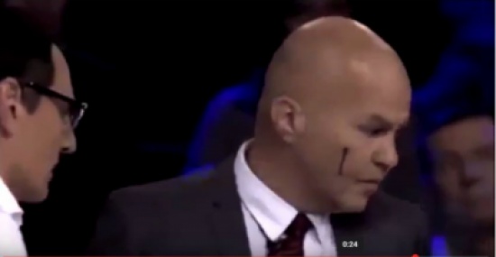 فيديو| صحفي يتهجم على محلل سياسي ويسيل الدماء من وجهه على الهواء مباشرة