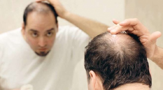 طريقة “مثيرة للدهشة” لعلاج تساقط الشعر