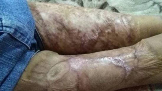 لماذا عجز الأطباء أمام حالة هذه الطفلة؟ لماذا عجز الأطباء أمام حالة هذه الطفلة؟