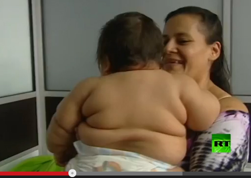 اضخم طفل في العالم