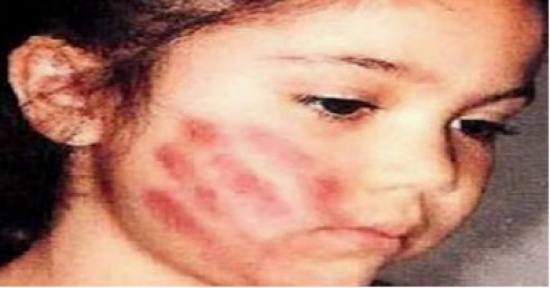 لماذا نهى الرسول الكريم عن الضرب على الوجه؟