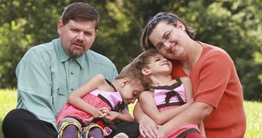 توأمتان ترتديان ملابس متماثلة لـ14 عاما