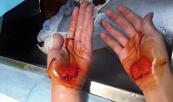بالصور.. مدرس يعاقب طلابه بالمشى على أيديهم