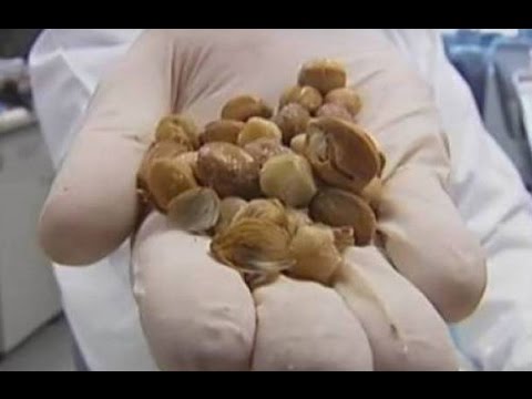 بشرى لجميع المصابين بالمرض الخبيث.. هذه الثمار تقتل السرطان في 5 دقائق بشرى لجميع المصابين بالمرض الخبيث.. هذه الثمار تقتل السرطان في 5 دقائق