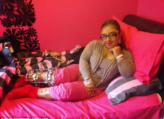 بسبب سخرية زملائها.. بريطانية تتحمل 5 سنوات من الألم والرقود لإطالة قامتها!