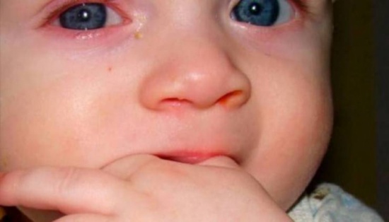 هذا الطفل فقد عينه.. بسبب أمر نفعله يوميا!!