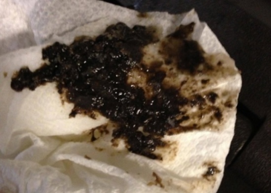 لقطة صادمة ستجعلك تتوقف عن وضع الثلج في مشروبك