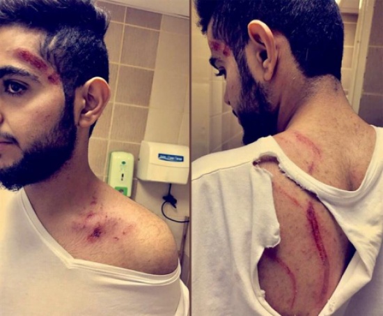 لبؤة تهاجم شاب وتمزق ملابسه .. ووالده يهدد بالتصعيد والمطالبة بالتعويض عن إصابة ابنه!