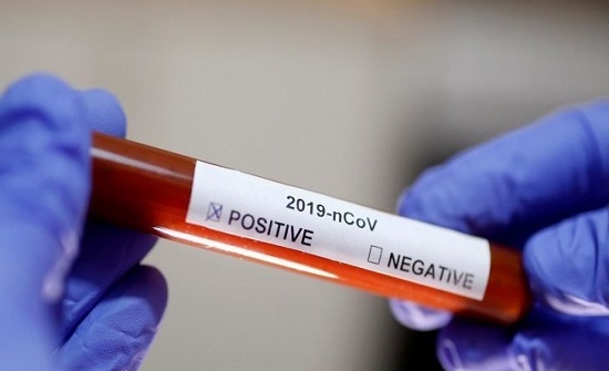 صحة مأدبا: نتائج 530 فحصاً لكورونا سلبية