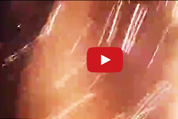 شاهد.. ألعاب نارية تسقط على منزل وتتسبب بحروق لأفراد عائلة برازيلية