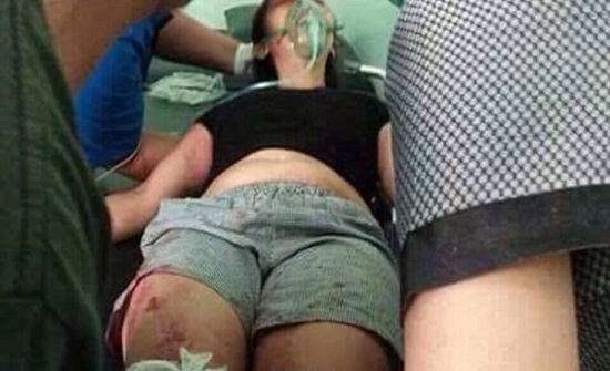 زوج يقطع ساق زوجته أمام أبنائها الصغار لهذا السبب .. صور