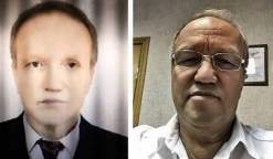 تحول إلى اللون الأسود بعد عملية زراعة كبد