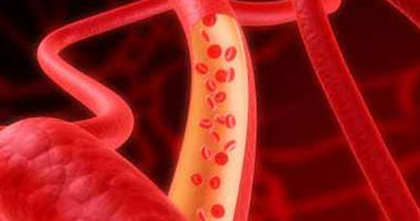 "جمعية الثلاسيما" تثمن قرار الحكومة صرف العلاج للاجئين السوريين