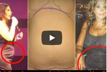 اليسا اجرت عملية شفط دهون وهذا هو الدليل " فيديو "