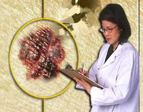 تطوير قذائف دوائية تدمر الخلايا السرطانية تطوير قذائف دوائية تدمر الخلايا السرطانية