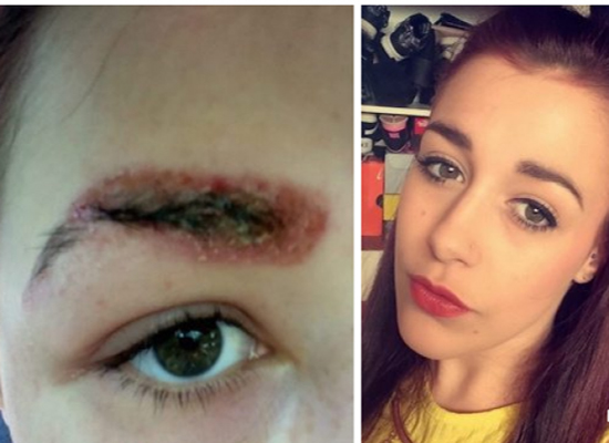 صور| بعد تاتو الحواجب .. هذا ما حصل لوجهها!