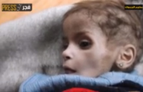 ضحايا الجوع في مخيم اليرموك 77 مدنياً