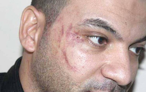 فنان يكشف عن صلة قرابته للعامل المصري الذي اعُتدي عليه في الأردن!!