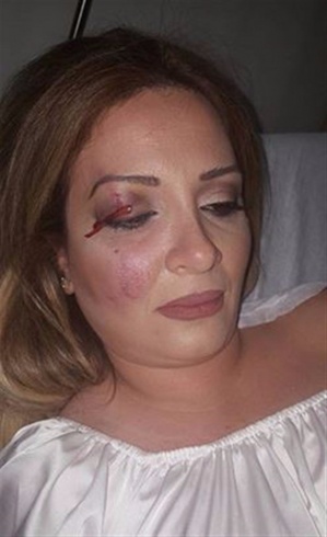 بالصور - نجاة إعلامية لبنانية من الموت... هذا ما حصل لها! بالصور - نجاة إعلامية لبنانية من الموت... هذا ما حصل لها!