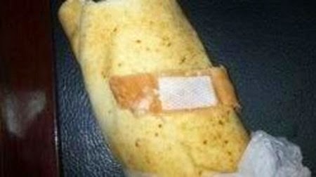 اشترى "سندويتش" فوجدها مجروحة ! اشترى "سندويتش" فوجدها مجروحة !