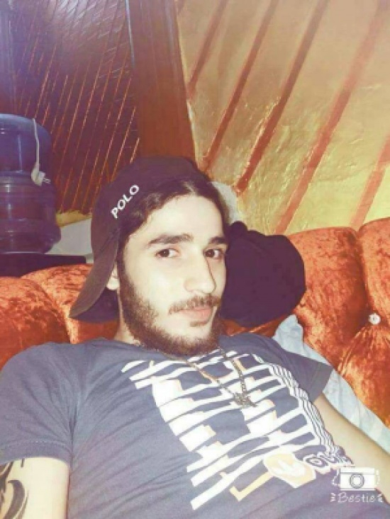 أحب قريبته الام لخمسة أولاد فهربت معه... السكين لا يزال عالقاً في رأس علاء أحب قريبته الام لخمسة أولاد فهربت معه... السكين لا يزال عالقاً في رأس علاء