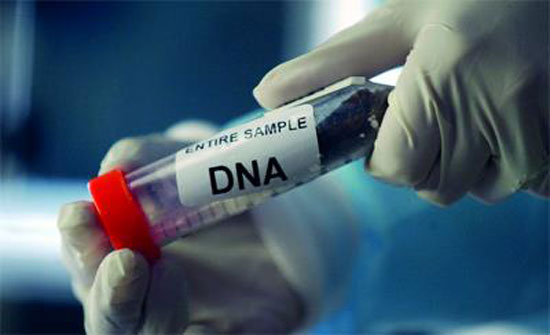 نتائج فحص الـ DNA للجثة المجهولة في البشير اليوم نتائج فحص الـ DNA للجثة المجهولة في البشير اليوم