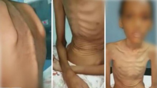 والدة أطفال خيبر: لست مريضة نفسيًّا.. وهذه حقيقة تعنيفي لأولادي والدة أطفال خيبر: لست مريضة نفسيًّا.. وهذه حقيقة تعنيفي لأولادي