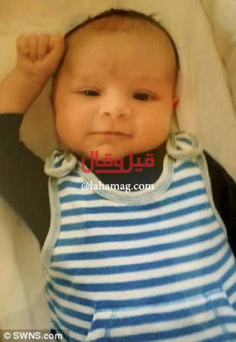 بالصور - طفل مصاب بمرض نادر.. يشرب الحليب ليبتسم! بالصور - طفل مصاب بمرض نادر.. يشرب الحليب ليبتسم!