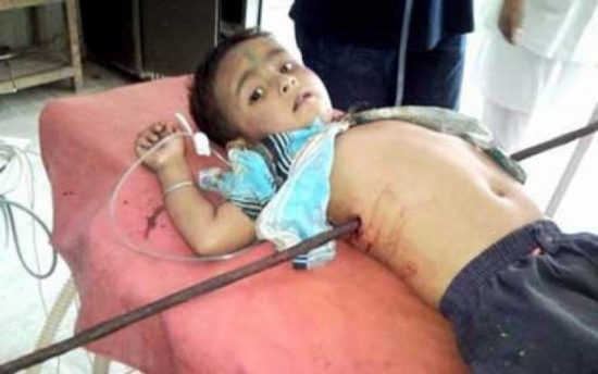 صورة| معجزة طفل ينجو من الموت بإعجوبة! صورة| معجزة طفل ينجو من الموت بإعجوبة!