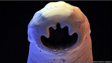 دعوة لحملة عالمية شاملة للقضاء على الديدان المعوية