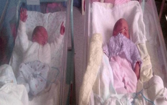 توأم لكن أحداهما وٌلد فى أنجلترا والأخر فى أسكتلندا " صور "