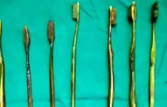 فتاة تبتلع 7 فراشي أسنان بعد محاولة إجبارها على الزواج فتاة تبتلع 7 فراشي أسنان بعد محاولة إجبارها على الزواج
