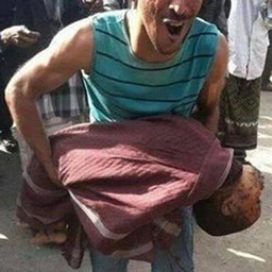 اصابة العشرات في غارات اسرائيلية على قطاع غزة اصابة العشرات في غارات اسرائيلية على قطاع غزة