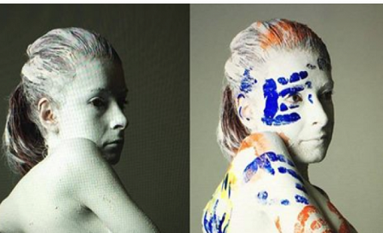 لقبوها بـ'حدباء نوتردام' بسبب إعاقتها... شاهدوا كيف أصبحت بعد 18 عاماً!