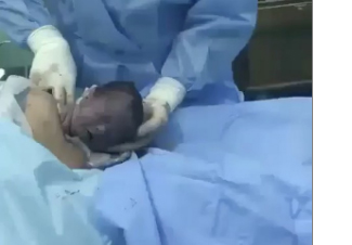 بالفيديو.. لقطات مذهلة لجنين يخرج من رحم أمه