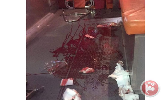 صور : إصابة شاب برصاص الاحتلال بنابلس