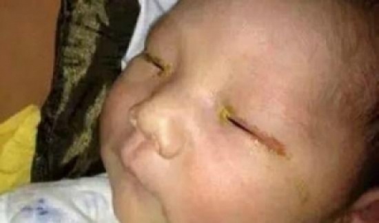 طفل رضيع يفقد بصره بسبب شيئ نفعله جميعاً ولا ننتبه إليه تحذير لكل ام