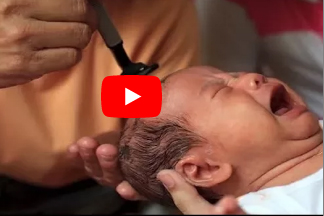 هل تعلم لماذا أمرنا رسول الله بحلق شعر الطفل بعد ولادته مباشرة.. !