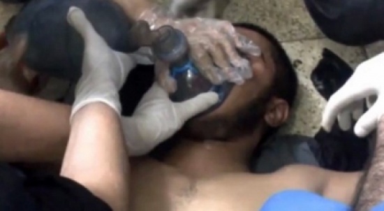 طبيب في " مجزرة الغوطة " هذا اليوم لن يمحى من ذاكرتي طبيب في " مجزرة الغوطة " هذا اليوم لن يمحى من ذاكرتي