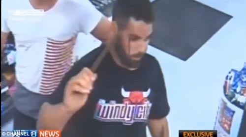بالفيديو والصور:شاب يقتحم متجرا بقضيب حديدي يخرج من رأسه بالفيديو والصور:شاب يقتحم متجرا بقضيب حديدي يخرج من رأسه