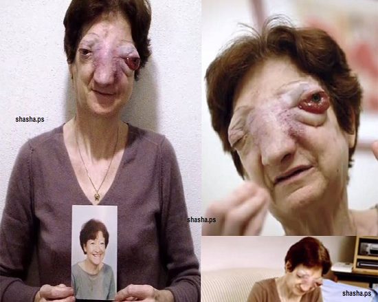 فيديو| 8 حالات للقتل الرحيم أثارت جدلاً واسعاً!