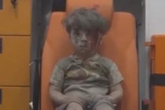 هل تذكرون الطفل عمران ذو الـ5سنوات والذي كاد أن يموت بسبب قصف قوات الأسد.. شاهده الأن هل تذكرون الطفل عمران ذو الـ5سنوات والذي كاد أن يموت بسبب قصف قوات الأسد.. شاهده الأن