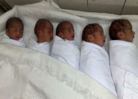 باكستانية تلد خمسة توائم بعد الحرمان من الأطفال 16 عاما