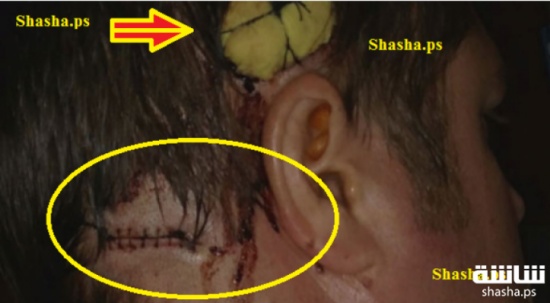 ذهب لحلاقة شعره كالعادة.. لكن ما حدث بعد ذلك مصيبة!