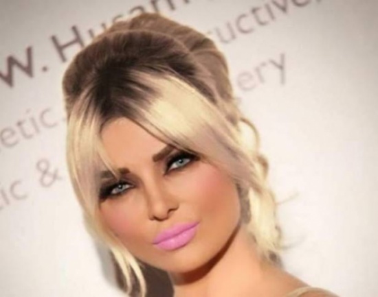 بالصورة- ميريام كلينك في تنورة جريئة!