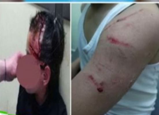 أب ينقذ طفلته بعد أن نهشت الكلاب رأسها في عمان - تفاصيل مؤلمة أب ينقذ طفلته بعد أن نهشت الكلاب رأسها في عمان - تفاصيل مؤلمة