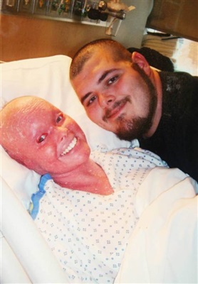 الصور.. إصابة امرأة بحالة نادرة في الجلد لم تمنعها من الأمومة