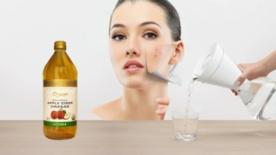 10 استعمالات تجميلية لخل التفاح 10 استعمالات تجميلية لخل التفاح