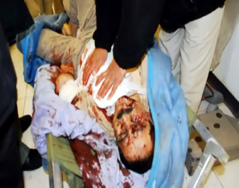 ليبرتي : التمهيد لمجزرة جديدة بعد تصريحات الملا بور محمدي ليبرتي : التمهيد لمجزرة جديدة بعد تصريحات الملا بور محمدي