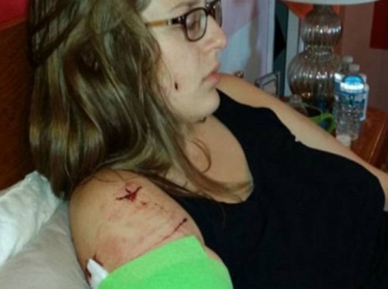 صور| خرجت لممارسة الرياضة لكن ما حصل لها كان مروعا!